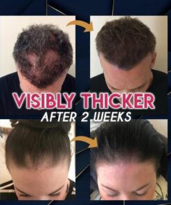 Esence pro růst vlasů Pure Grow