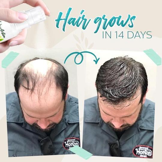 Hair-Active Root-Boost Ginger Spray - Image 2