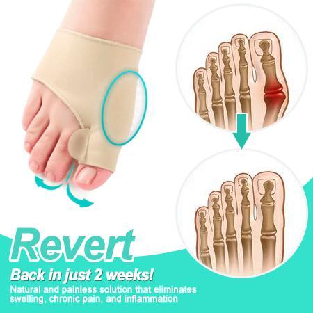 NATURAL FEET Corrector Bunion Corrector - Image 2