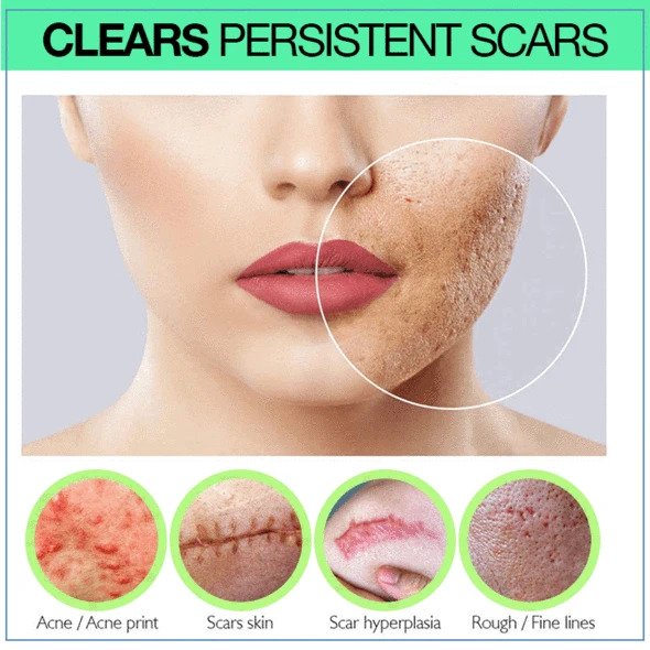 PRO Niacinamidové sérum na jizvy - Image 3