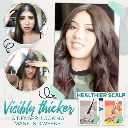 Hair-Active Root-Boost Ginger Spray - Image 4