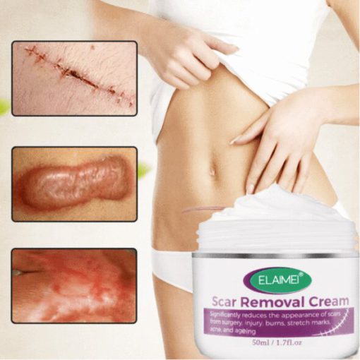 Skin Rebound Scarless Cream - Image 4