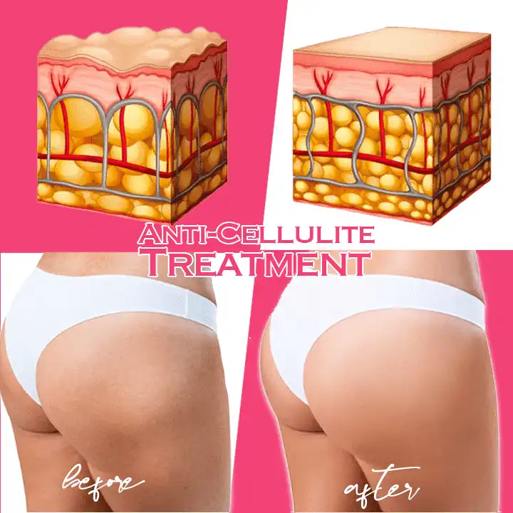 Kofeinový zpevňující a tónovací krém - Image 4