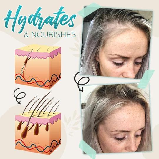 Hair-Active Root-Boost Ginger Spray - Image 5