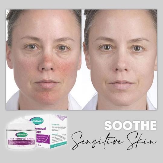 Medease Skin Rebound Cream - Image 6