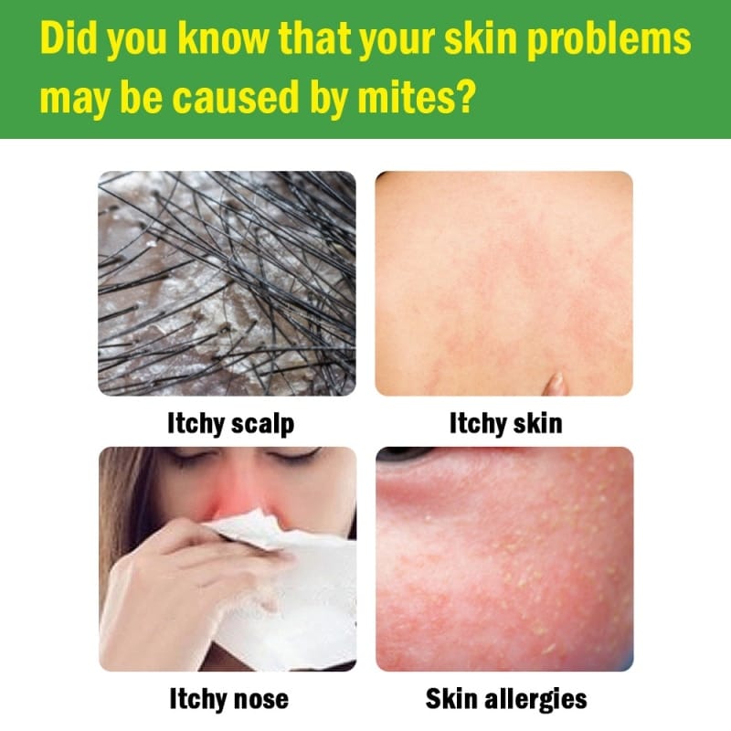 PŘÍRODNÍ LIKVIDACE ROZTOČŮ - Image 6