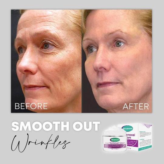 Medease Skin Rebound Cream - Image 7