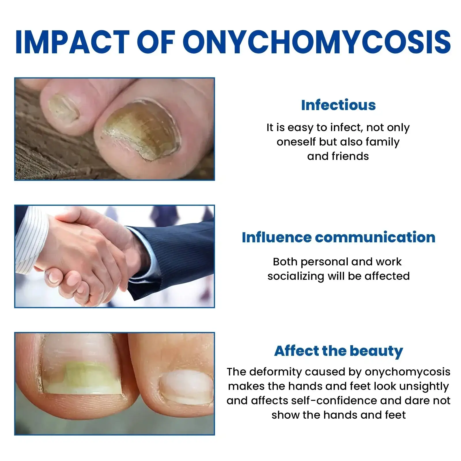 Acezozla® houbové náplasti na opravu nehtů - Image 2