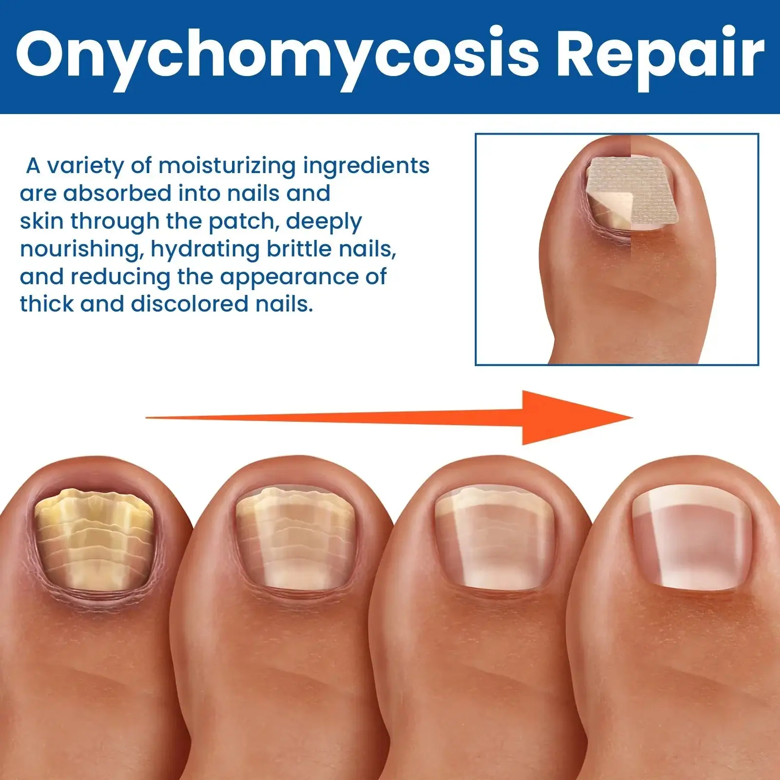 Acezozla® houbové náplasti na opravu nehtů - Image 4