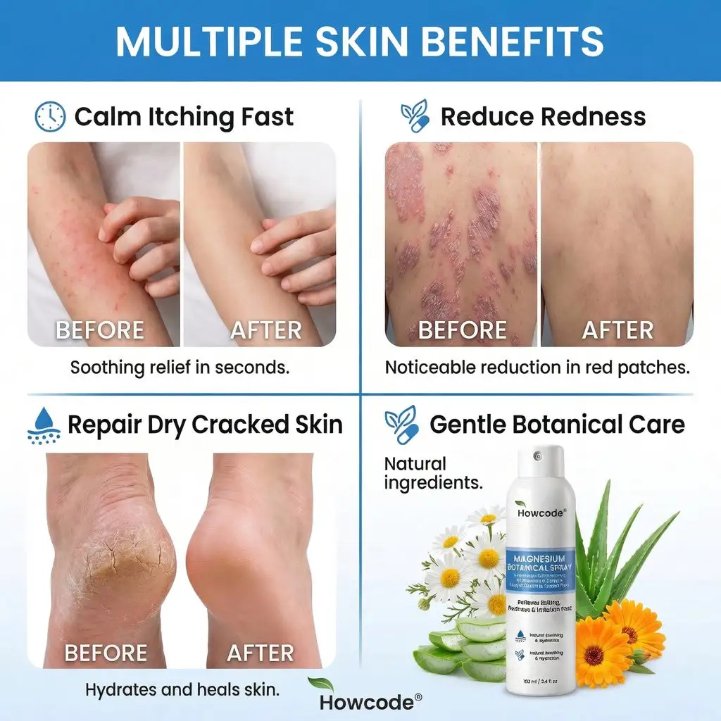 Howcode® Hořčíkový botanický sprej - Image 5