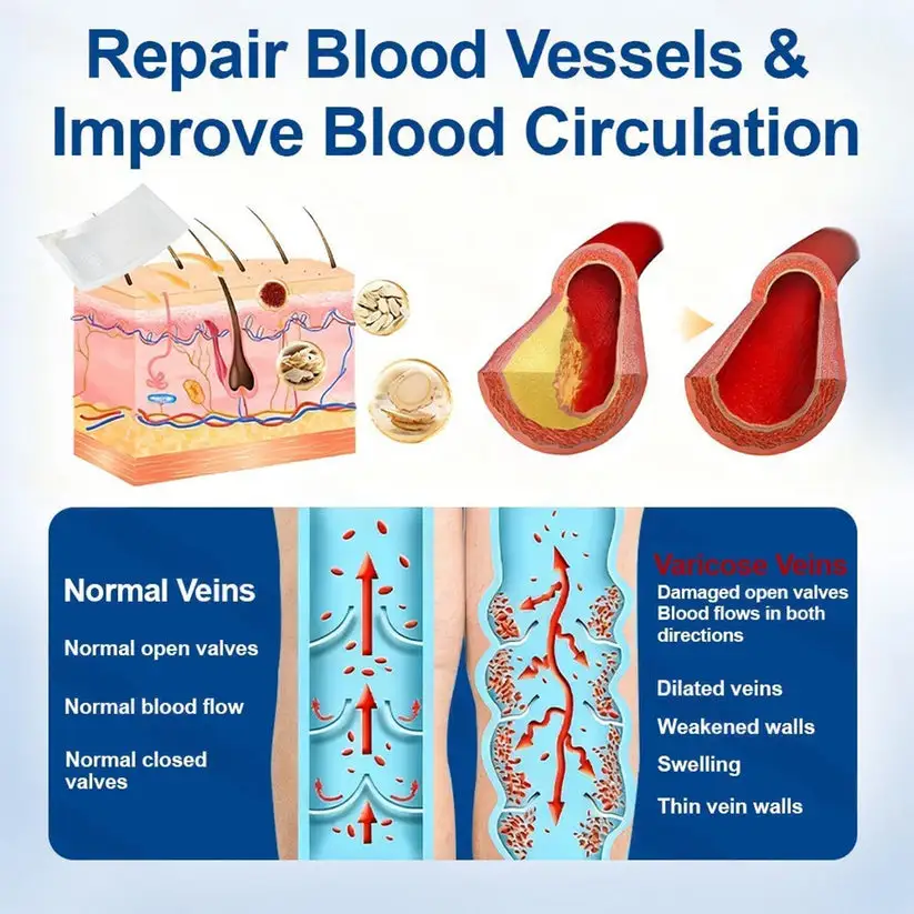 Mikrojehličková náplast VERVEBEAD™ Vein Ease - Image 8