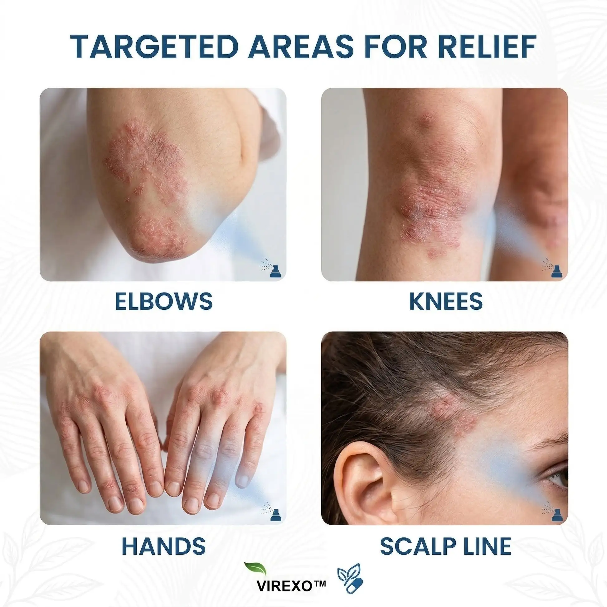 Virexo™ hořčíkový botanický sprej - Image 2